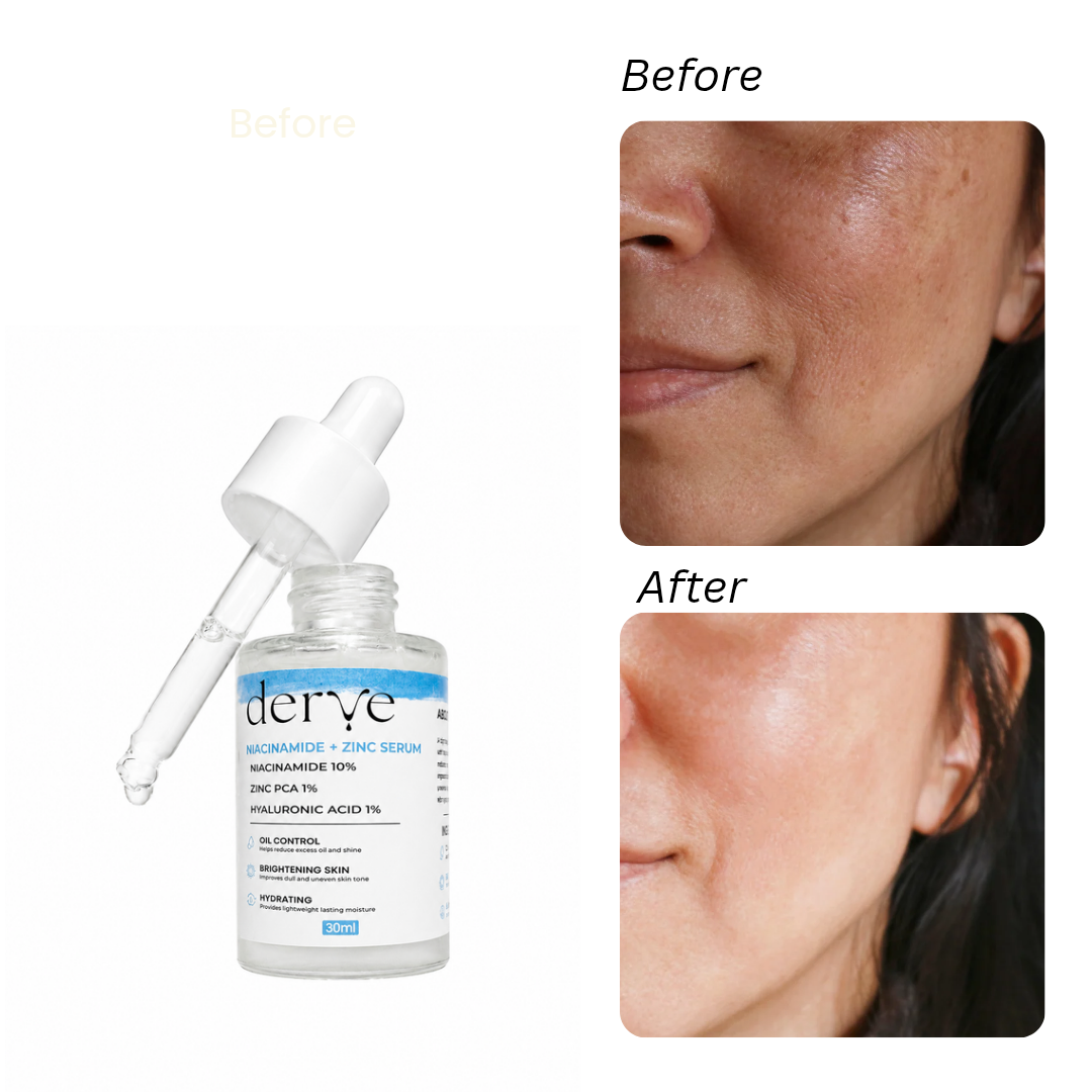 Niacinamide Serum