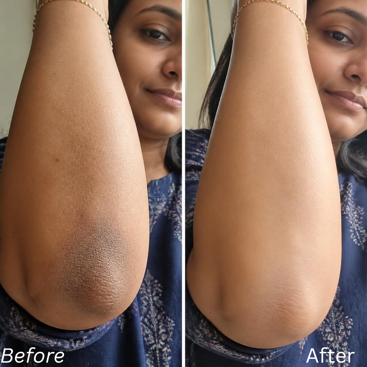 Glycolic Acid 7% Toning Solution