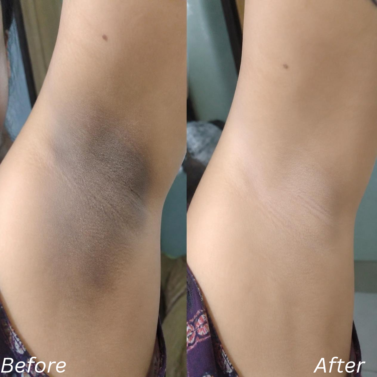 Glycolic Acid 7% Toning Solution